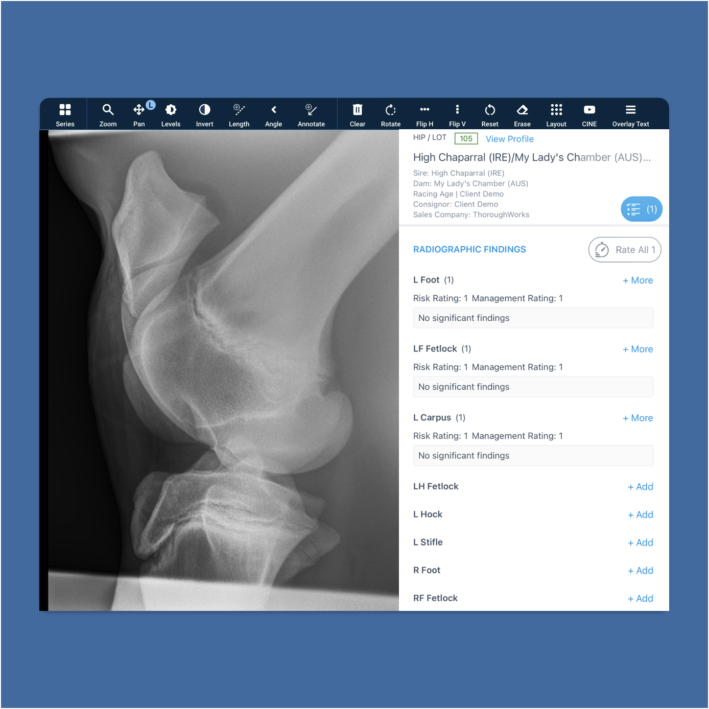 X-Ray Report in Viewer